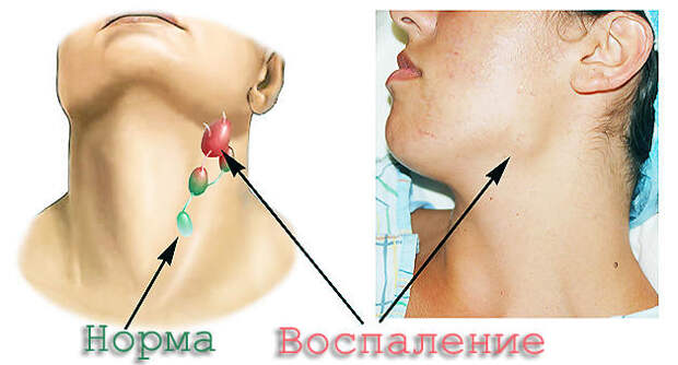 Картинки по запросу лимфоузлы