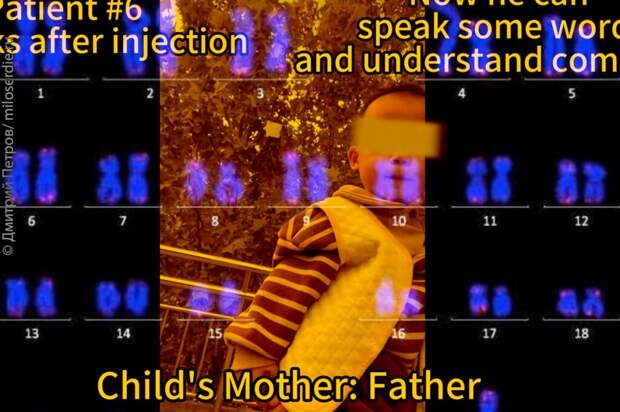Коллаж. Глухие от рождения дети стали слышать в результате нового эксперимента в области генной инженерии