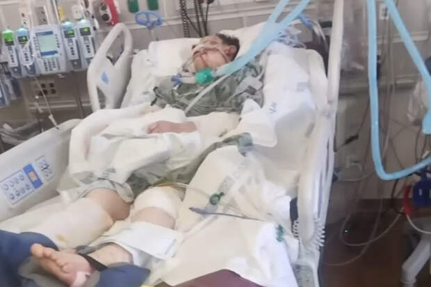 Неизвестный хищник тяжело ранил женщину