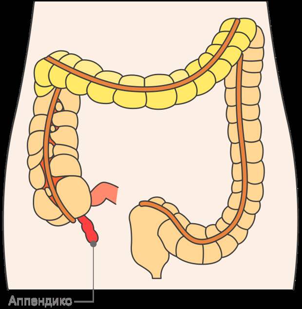 Аппендикс — участок толстой кишки. Когда он воспаляется, возникает аппендицит