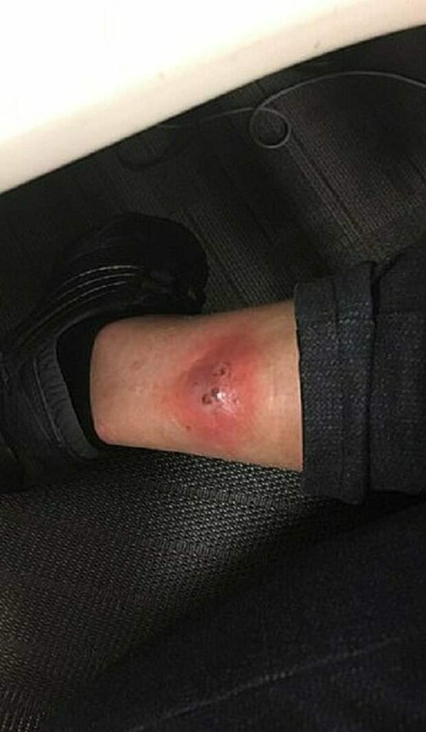 Укус паука и вы больше не веган, или здоровье превыше принципов Укус паука и вы больше не веган, или здоровье превыше принципов