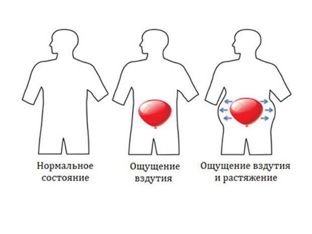 Повышенное газообразование – это одна из тех проблем, о которых не принято говорить вслух.-11