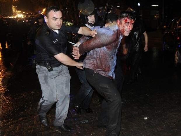 Police detain protesters during clashes in Tbilisi
