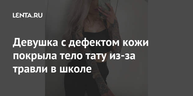 Девушка с дефектом кожи покрыла тело тату из-за травли в школе