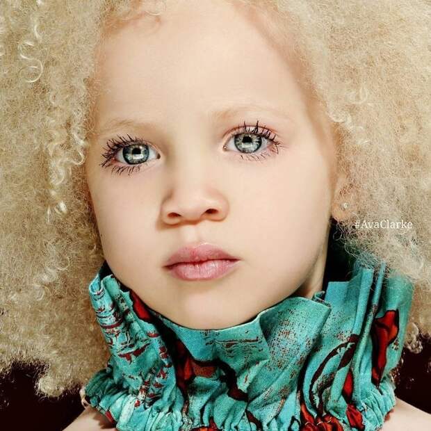 Ава Кларк – 8-летняя девочка-альбинос, ставшая юной афроамериканской моделью девочка, красивая, модель, фото