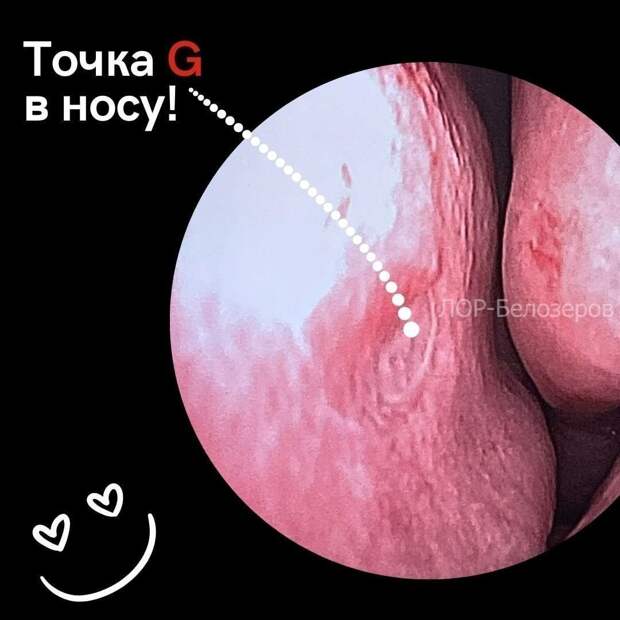 Лор-хирург из Нижнего Новгорода рассказал, где в носу находится точка G