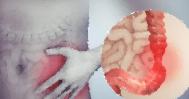 Метаанализ 124 исследований выявил лабораторные маркеры при синдроме раздражённого кишечника