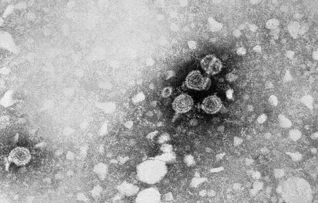 Вирионы вируса гепатита B