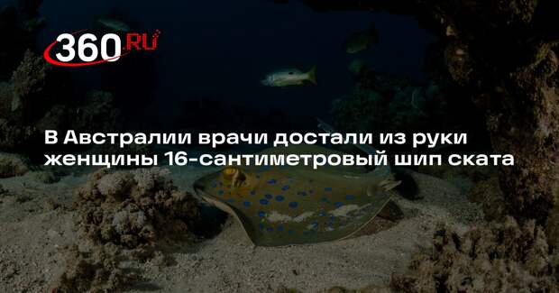ABC News: в Австралии скат вонзил в женщину 16-сантиметровый шип