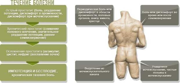 Это только первые симптомы простатита, которые свойственны каждому виду заболевания