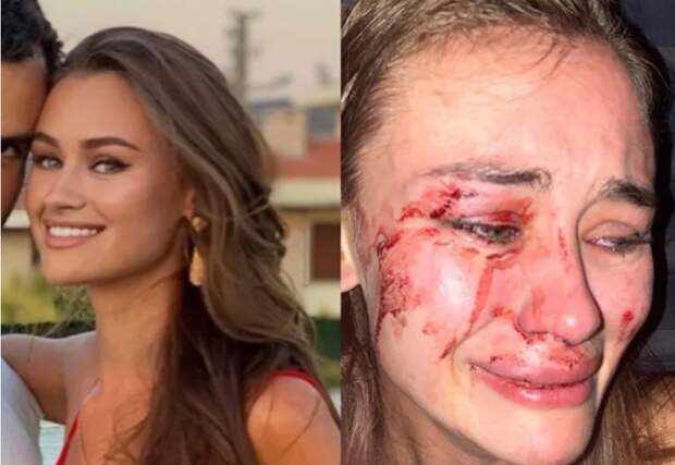 Дарья Кирилюк побита