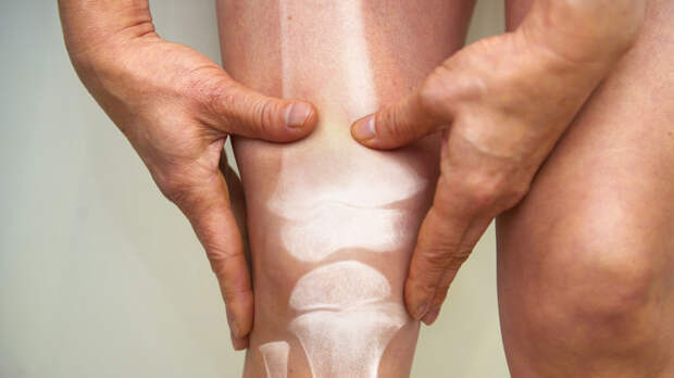 Врач Калинский назвал лишний вес врагом суставов