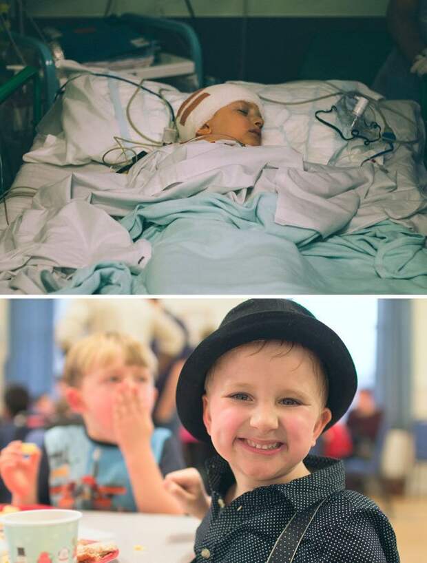9. 14 раундов химиотерапии, 30 раундов лучевой терапии, 4 операции... Но мальчика спасли! вдохновляющее, выжившие, до и после, заболевание, рак, сильные духом