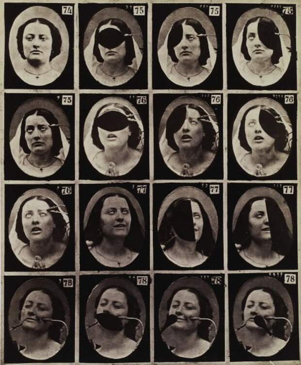 Леденящие душу старинные фотографии экспериментов по неврологии (25 фото)