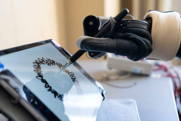 В России представили первый модуль локтя, совместимый с бионическими кистями