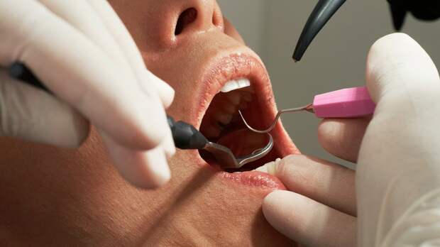 Первый МГМУ: запустить регенерацию десны можно с помощью лазера