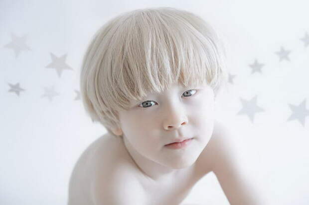 Красота альбиносов в фотографиях Yulia Taits