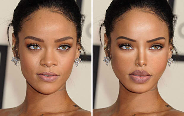 Так после пластических операций изменилось бы лицо известной певицы Рианны (Rihanna).