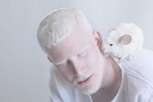 albinos_7