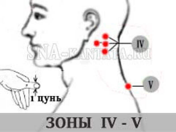 zona-umanskoj-IV-V