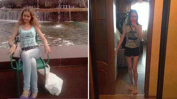 «Не могу спать и есть»: жительница Ульяновска больше года пытается восстановиться после коронавируса