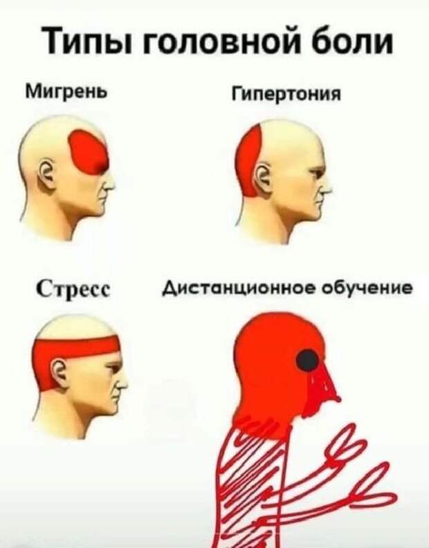 На изображении может находиться: текст «типы головной боли мигрень гипертония стресс дистанционное обучение 은»