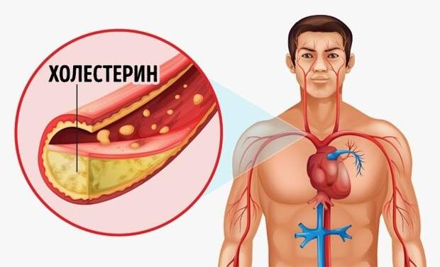 Чистые сосуды бананы, полезно, факты