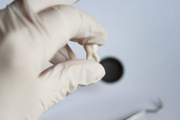 Впавшая в кому в Таиланде после удаления зуба российская туристка не выжила