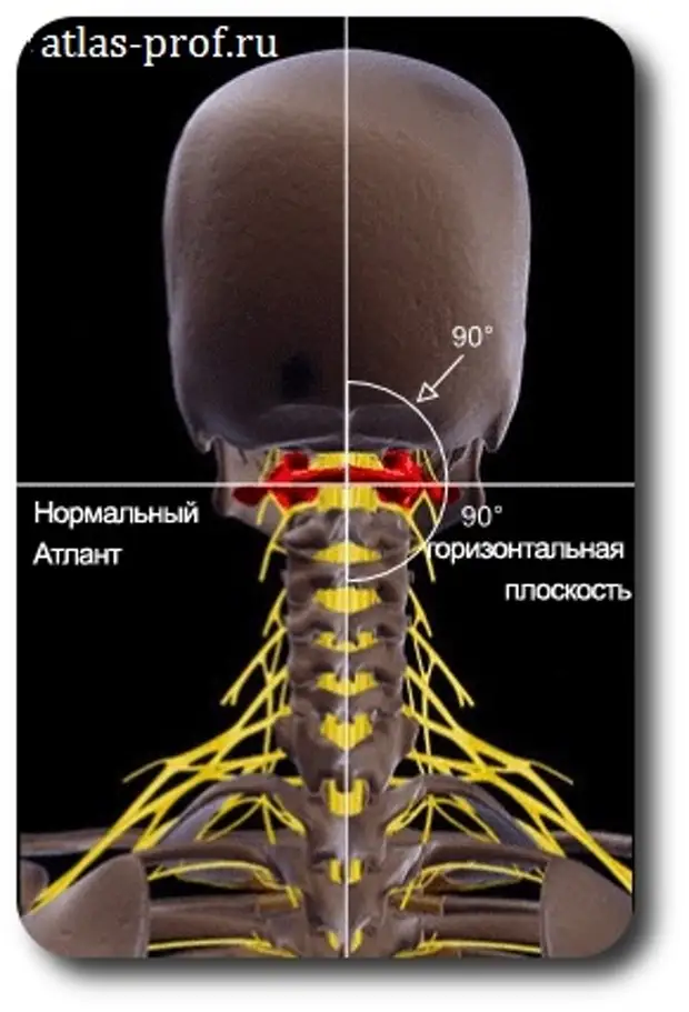 Картинка атланта позвоночника