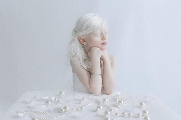 Красота альбиносов в фотографиях Yulia Taits