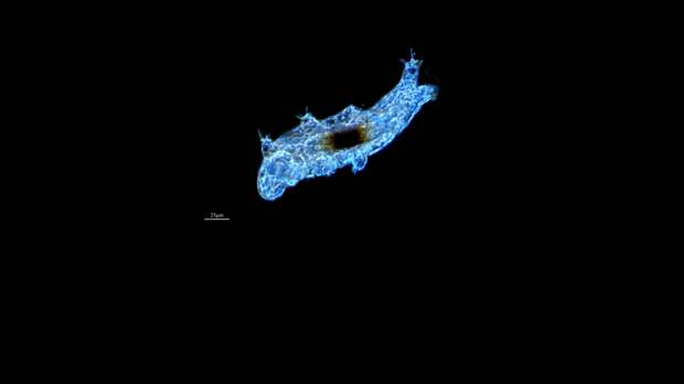 microagua / flickr.com
