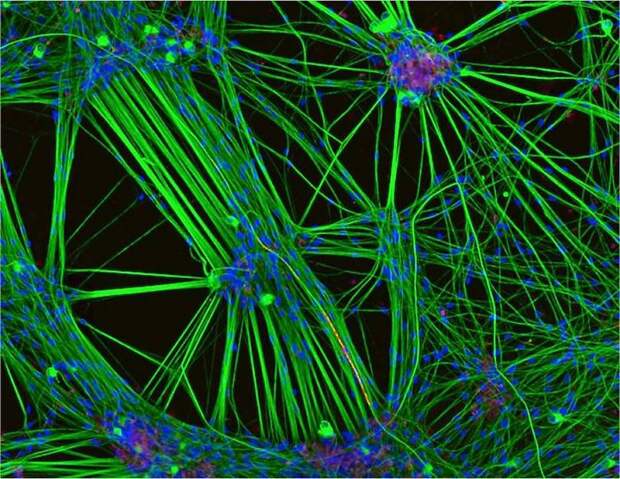 Third Place. Brain Cells From Skin Cells