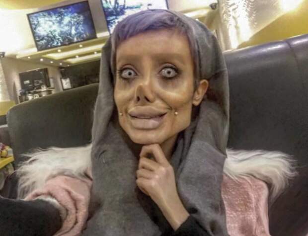 Иранка сделала 50 операций ради сходства с Анджелиной Джоли Сахар Табар, анджелина джоли, внешность, изменение, лицо, операция, фигура