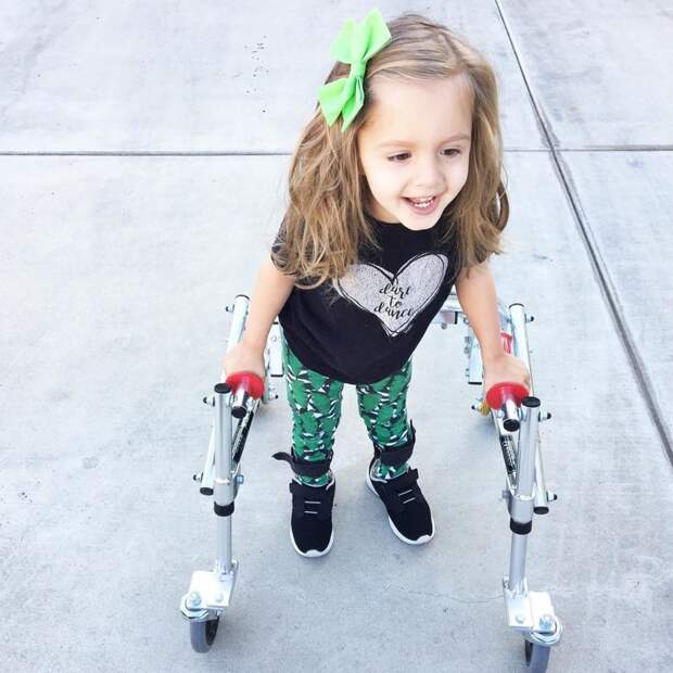Эта трехлетняя малышка с ДЦП стала новой иконой стиля Instagram, девочка, дцп, мода