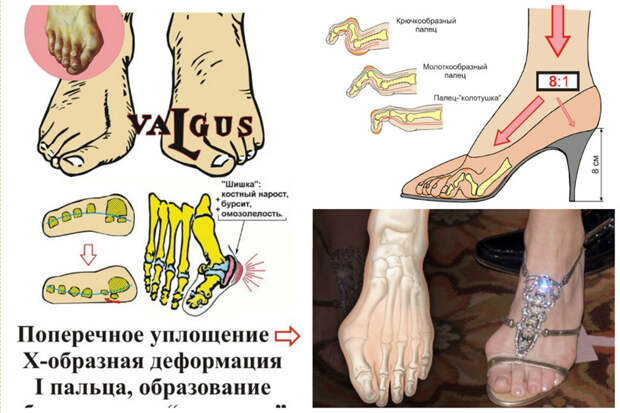 Но главное - каблуки ломают ваши ножки женщины, жизнь, интересное, каблуки, ситуации, смешное, юмор