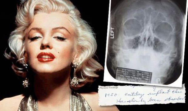 Какой была пластическая хирургия в Голливуде семьдесят лет назад