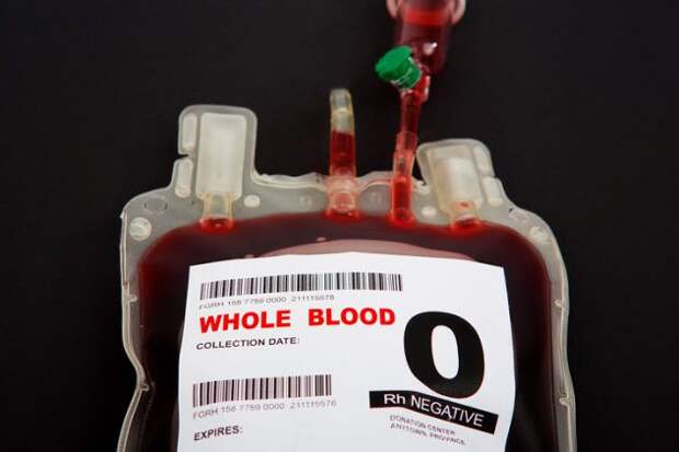 Любопытное о переливании крови
