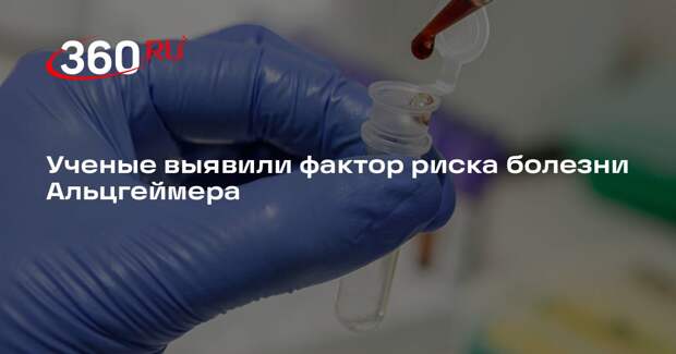 Nature Aging: у носителей гена APOE4 нашли ранние изменения в работе мозга