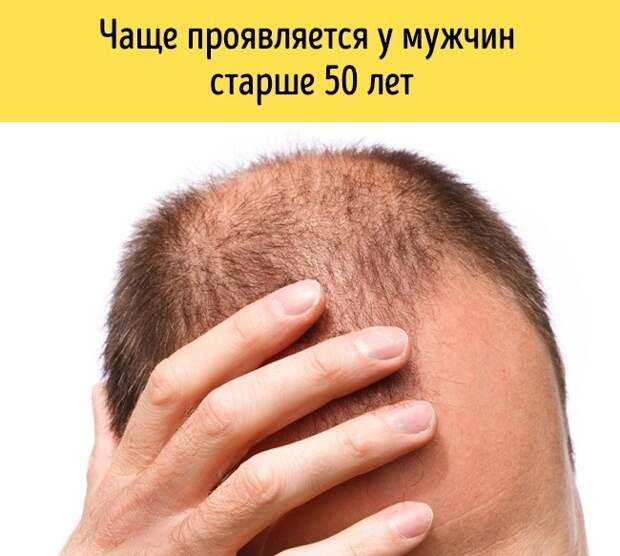 За месяц до сердечного приступа организм начнет вас предупреждать. 8 главных симптомов За месяц до сердечного приступа организм начнет вас предупреждать. 8 главных симптомов
