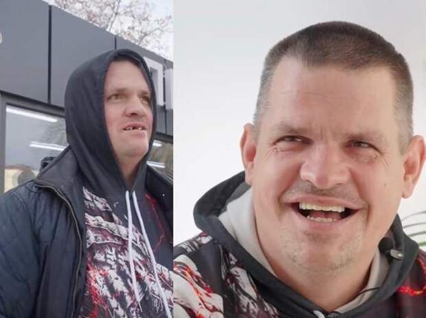 Жителю Туапсе с ДЦП бесплатно восстановили зубы в рамках благотворительного проекта