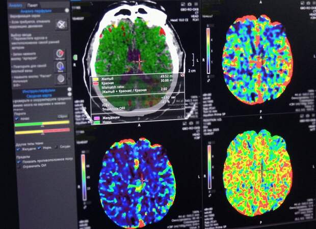 В Рязани женщине стало плохо на улице, прохожие и врачи спасли её от последствий инсульта