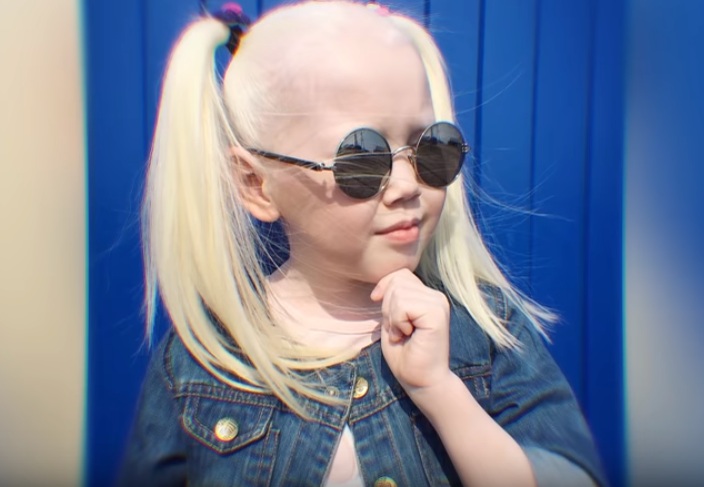 9-летняя девочка-альбинос из Якутии: модельные агентства наперебой предлагают ей контракты. Фото