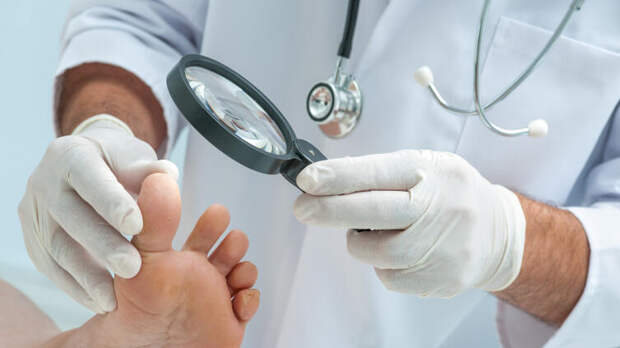 Как проявляется грибок кожи?​.