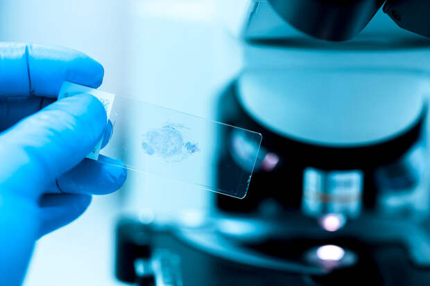 PNAS: белок MARCHF8 позволяет раку головы и шеи скрываться от иммунных атак