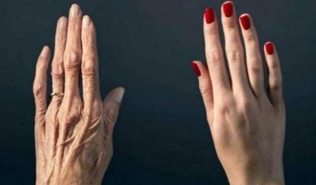 1459964414n4kg8-520x304