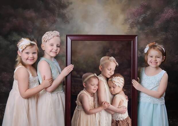 Фото этих больных раком девочек облетело весь мир. Но посмотри, что с ними произошло 2 года спустя!