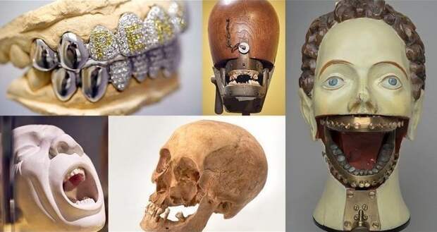 Как рвали зубы в раньше: искусство и стоматология в мире, зубы, искусство, люди, медицина, стоматология