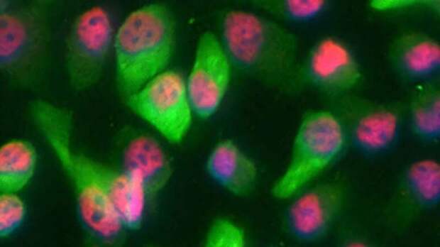 Рак кожи использует один белок для быстрого роста и уклонения от иммунных клеток