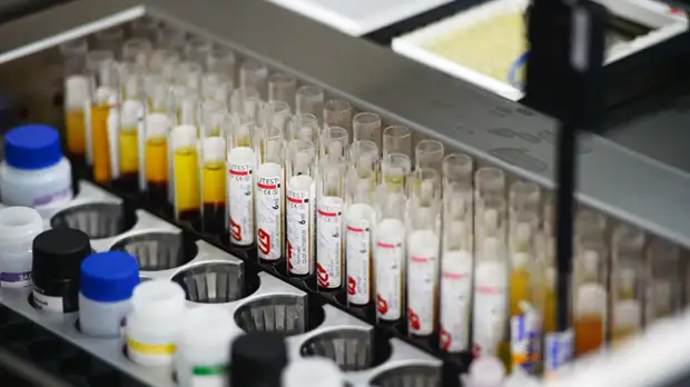 Новый штамм ВИЧ обнаружен впервые за почти 20 лет