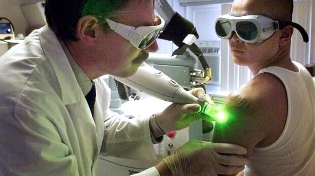 Куда пропадают чернила после удаления татуировки